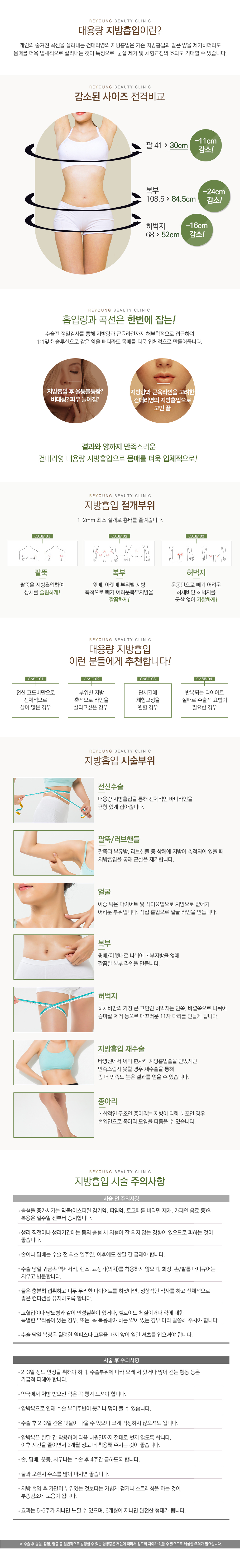 지방흡입