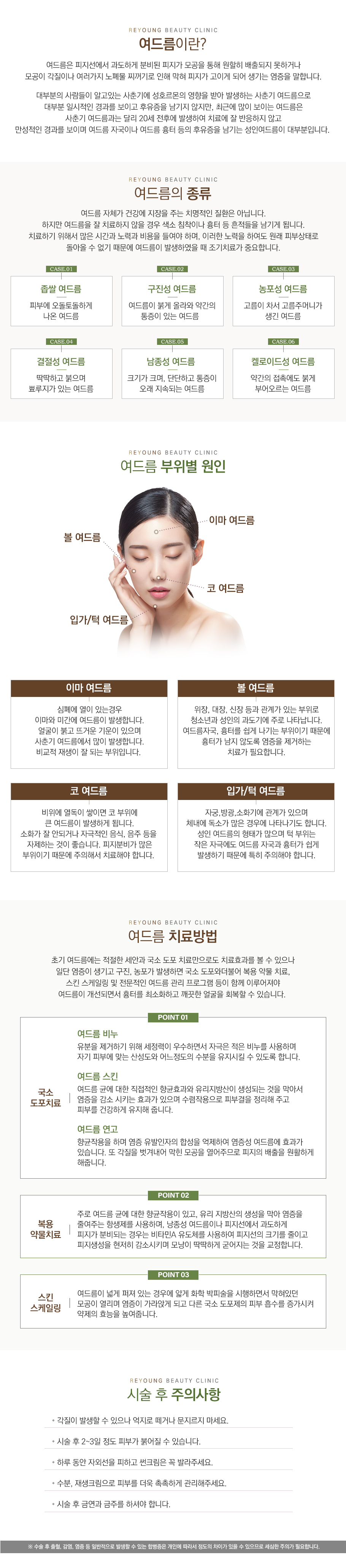 여드름