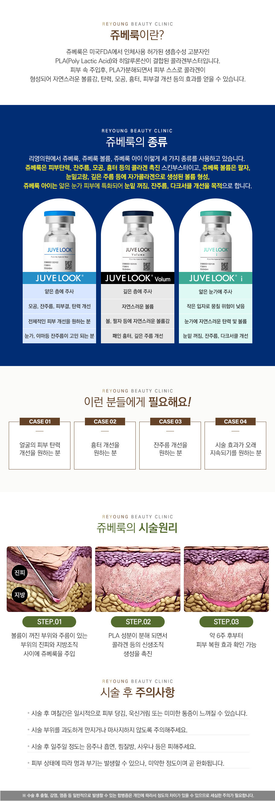 쥬베룩