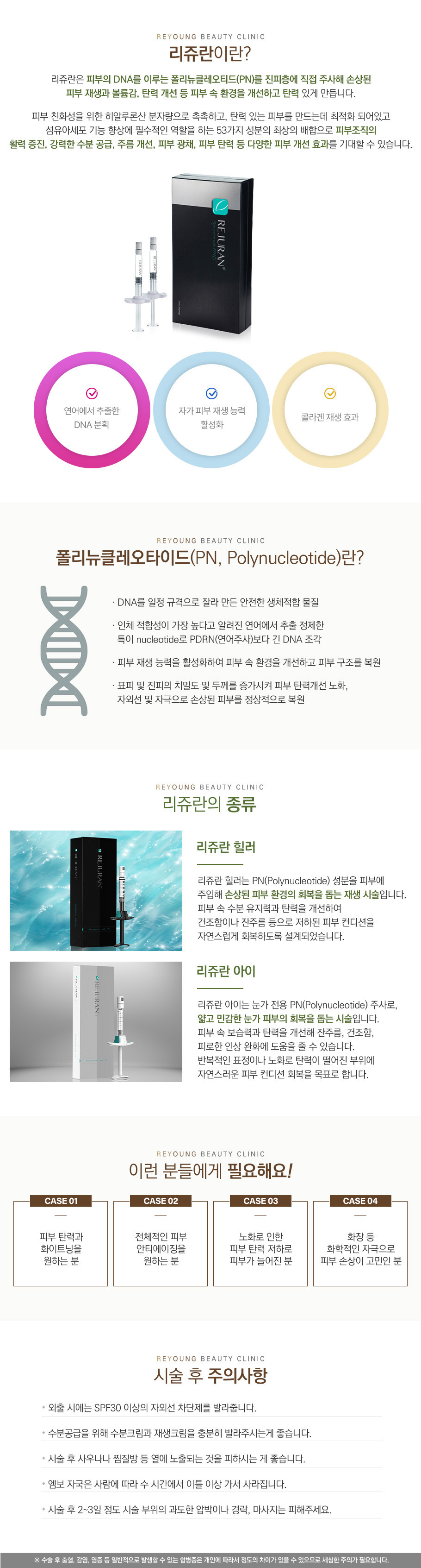 리쥬란