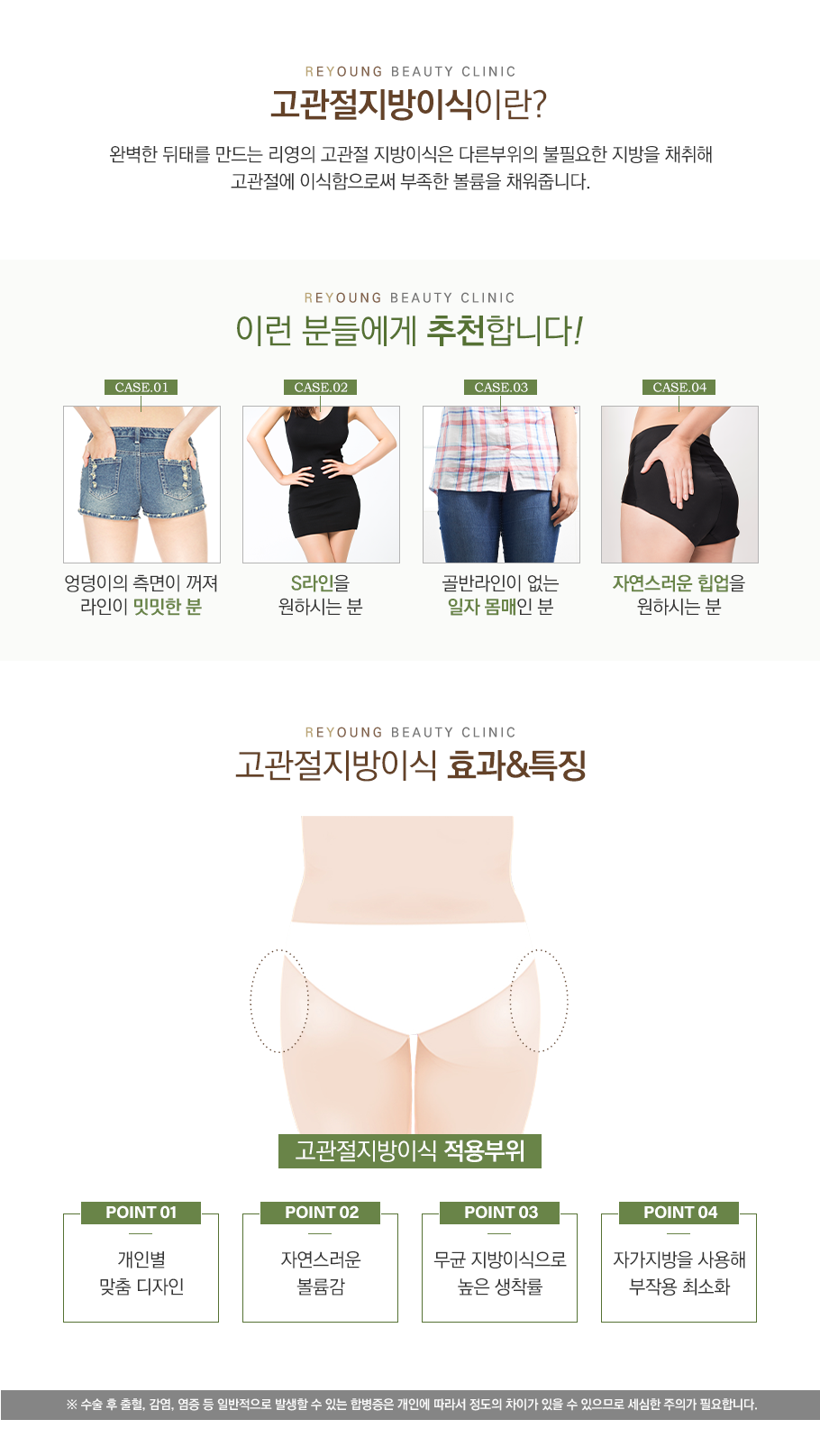 고관절지방이식