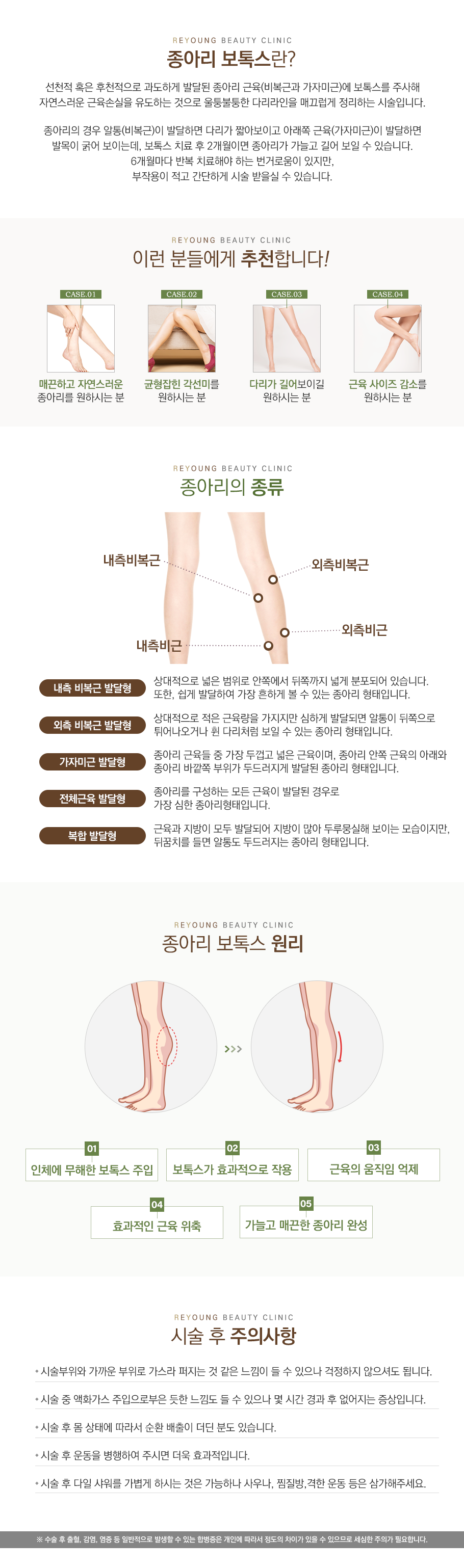 종아리보톡스