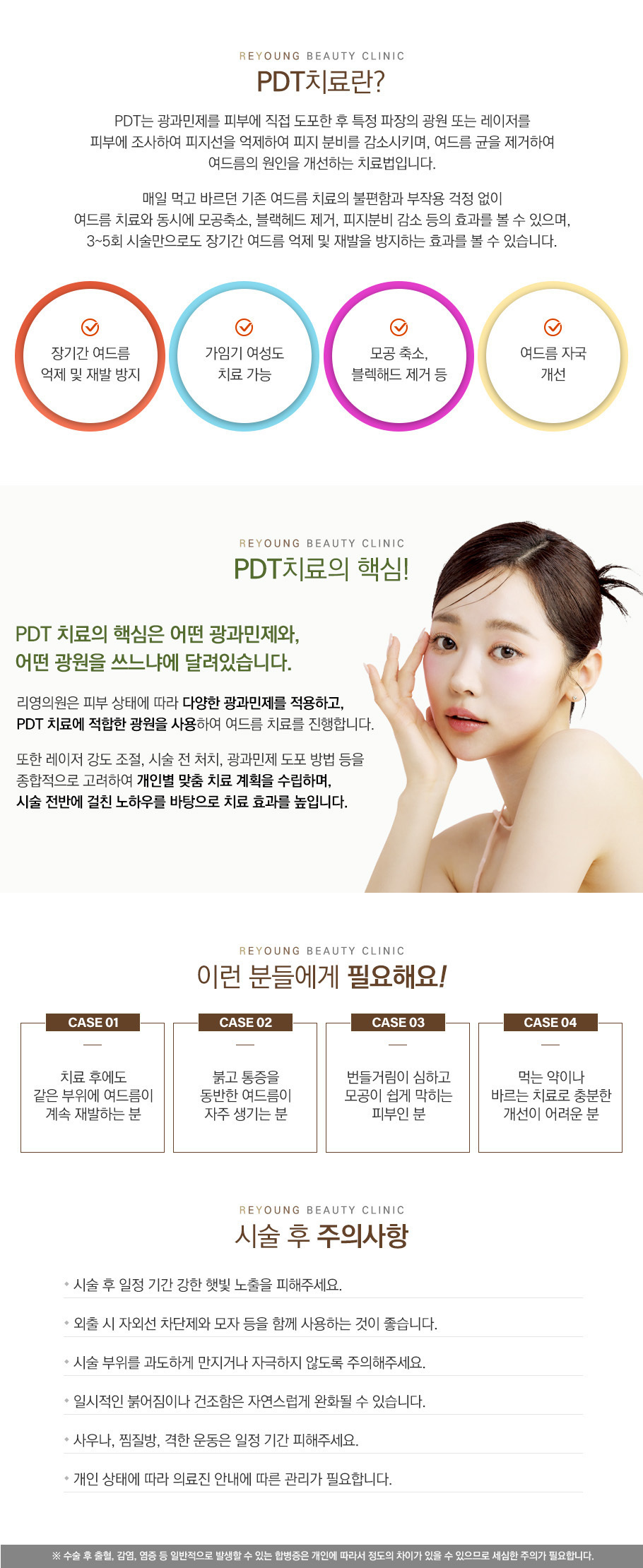 PDT